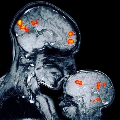 Que pasa en el cerebro cuando una madre besa a su hijo?