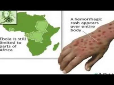 El Ebola